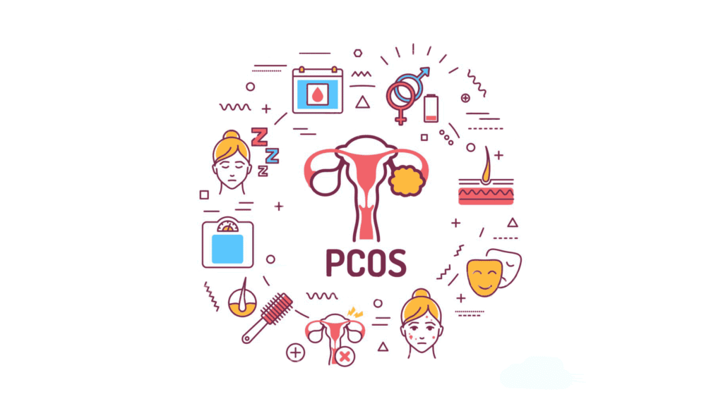 PCOS