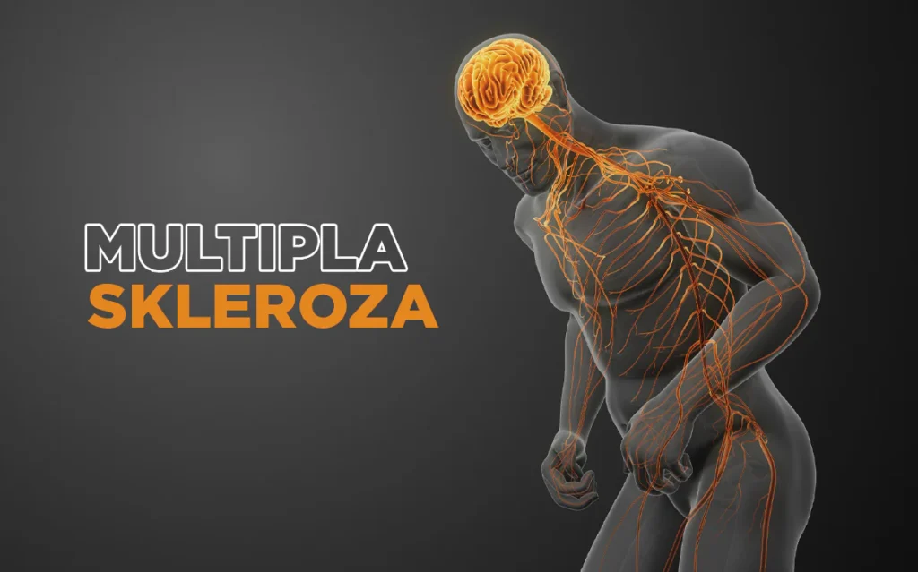 fotografija multiplaSkleroza 1 1024x639 1